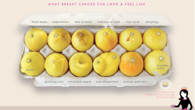 Photo of Radiant Health Breast Cancer Resources