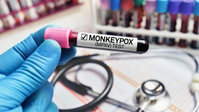 Photo of Monkeypox On The Rise In The LBGTQ Community, Here’s How To Stay Safe
