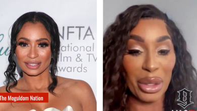 Photo of Black America Responds To Karlie Redd’s New Look And Trends In Plastic Surgery