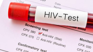 Photo of Which HIV Test is the Most Accurate?