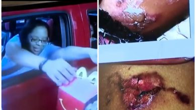 Photo of Jury Finds McDonald’s Liable In Lawsuit After Florida Parents Claim 4-Year-Old Daughter Was Burned By ‘Dangerously Hot’ Chicken Nuggets That Left Her Thigh ‘Disfigured and Scarred’