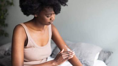 Photo of 7 “Don’ts” for Black Folks with Eczema