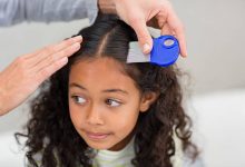 Photo of CDC’s Latest Heads Up: Black People Can Get Lice, Too