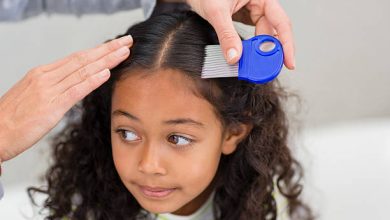 Photo of CDC’s Latest Heads Up: Black People Can Get Lice, Too