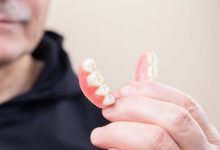 Photo of All on 4 Dental Implants vs Dentures: Pros and Cons