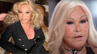 Photo of Cause of Death Revealed for Billionaire ‘Catwoman’ Jocelyn Wildenstein, Who Survived on $900 Social Security After Blowing Through Fortune