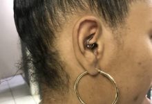 Photo of I Tried This To Stop My Migraines…This Worked