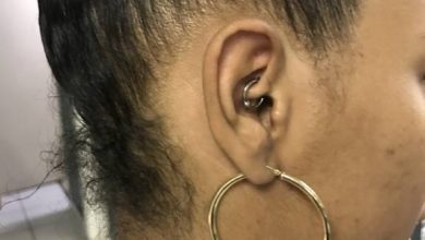 Photo of I Tried This To Stop My Migraines…This Worked