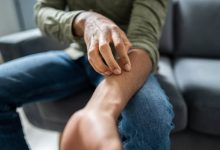 Photo of 10 Signs it’s Time to See a Doctor About Your Skin Rash