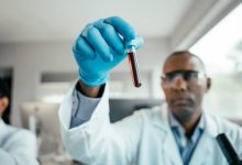 Photo of New Blood Test Could Change How You Monitor Your Health