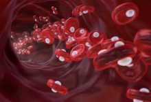 Photo of 5 Signs Your Red Blood Cell Count Is Too Low