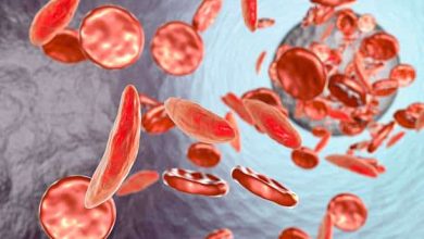 Photo of Sickle Cell Disease Pain Front and Center at Summit for Warriors, HCPs – BlackDoctor.org