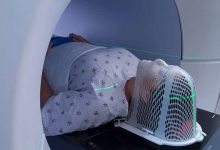 Photo of Can You Safely Skip Radiation Therapy? – BlackDoctor.org