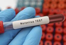Photo of Norovirus is on the Rise: 7 Symptoms to Look For – BlackDoctor.org
