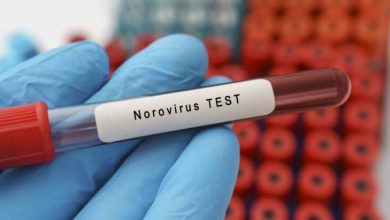 Photo of Norovirus is on the Rise: 7 Symptoms to Look For – BlackDoctor.org