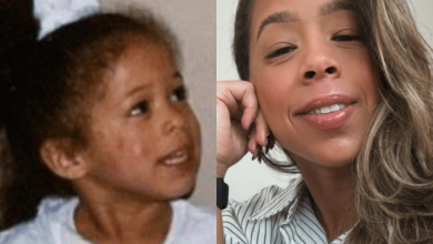 Photo of I Did An Eczema Clinical Trial and Found Healing and Purpose