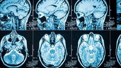 Photo of Different Types of Brain Tumors: What They Are, How They Present and What To Expect – BlackDoctor.org