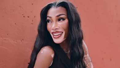 Photo of Winnie Harlow Reflects on Growing Up With Vitiligo