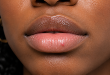 Photo of 5 STDs That Are Worse At Night – BlackDoctor