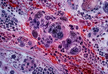 Photo of 8 Diseases Where You Don’t See the Symptoms for Years – BlackDoctor