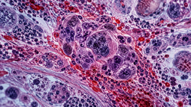 Photo of 8 Diseases Where You Don’t See the Symptoms for Years – BlackDoctor